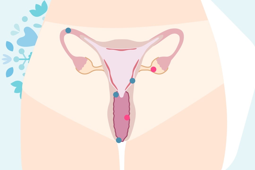 Graphique du vagin